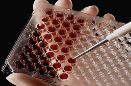 HIV heteroseksuāla pārnešana: jauni atklājumi