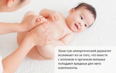 Alerģisks dermatīts bērnam