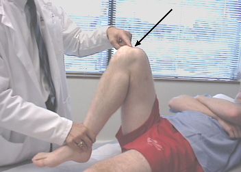 Ceļa sāpes saliekšanās laikā ir visbiežākais iemesls, kāpēc cilvēki apmeklē traumatologus.