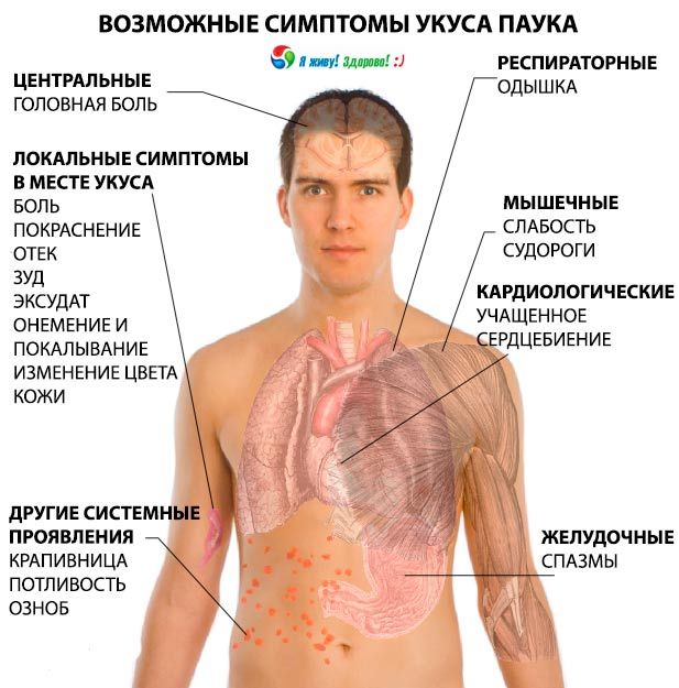 Zirnekļa koduma simptomi