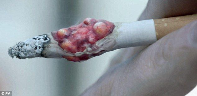 Apvienotajā Karalistē uzsākta biedējoša pretcigarešu reklāma