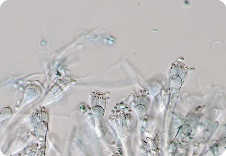 Viena no Aspergillus ģints sēnēm