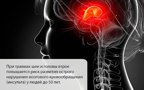 Insulta risks palielinās pirmajos mēnešos pēc galvas vai kakla traumas.