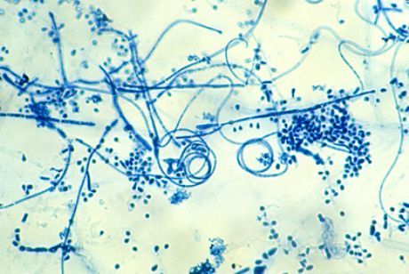 Sportista pēdas izraisītājs (Trichophyton interdigitale)